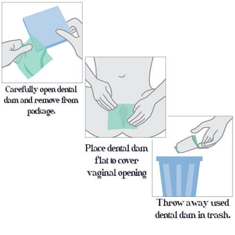 Latex dental dams Olivia Oral Dams Mint 6 pcs mint — photo 7